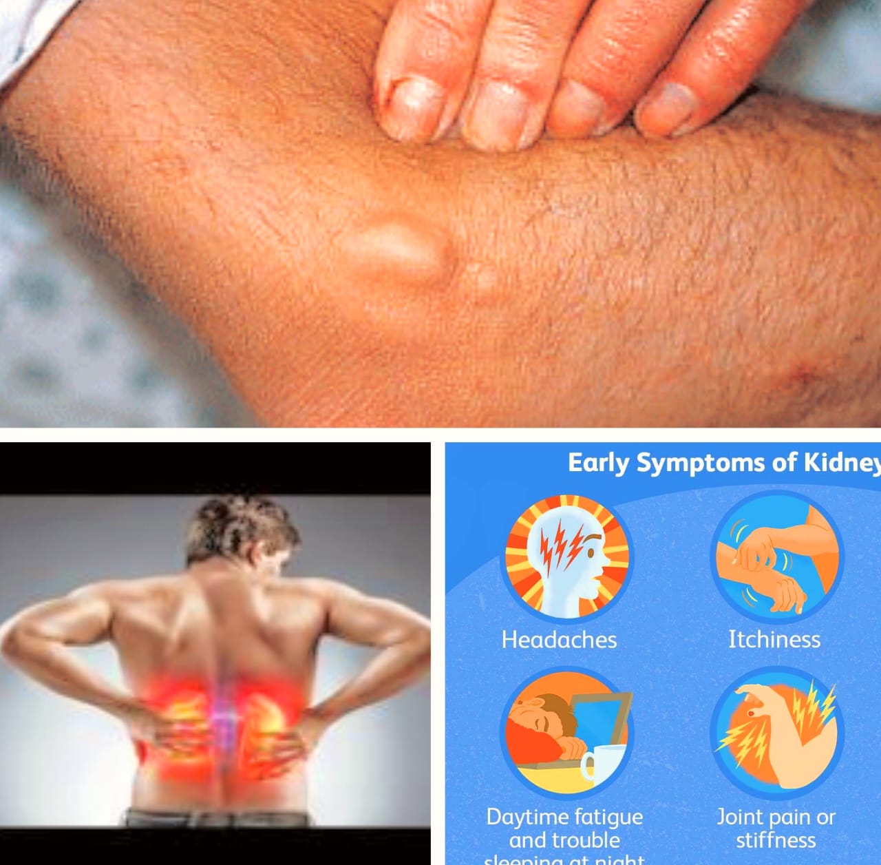 #signs of kidney #disease,early signs of kidney #disease,kidney #disease,early #warning signs of kidney warning signs of kidney disease,chronic kidney disease,kidney disease symptoms,early warning signs of kidney failure,kidney disease signs,signs of kidney problems,warning signs of kidney failure,early symptoms of kidney disease,kidney disease